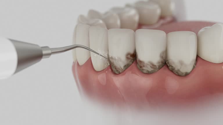 Reliable Dental contractor in Upton, WY by Smile Center Dentistry
